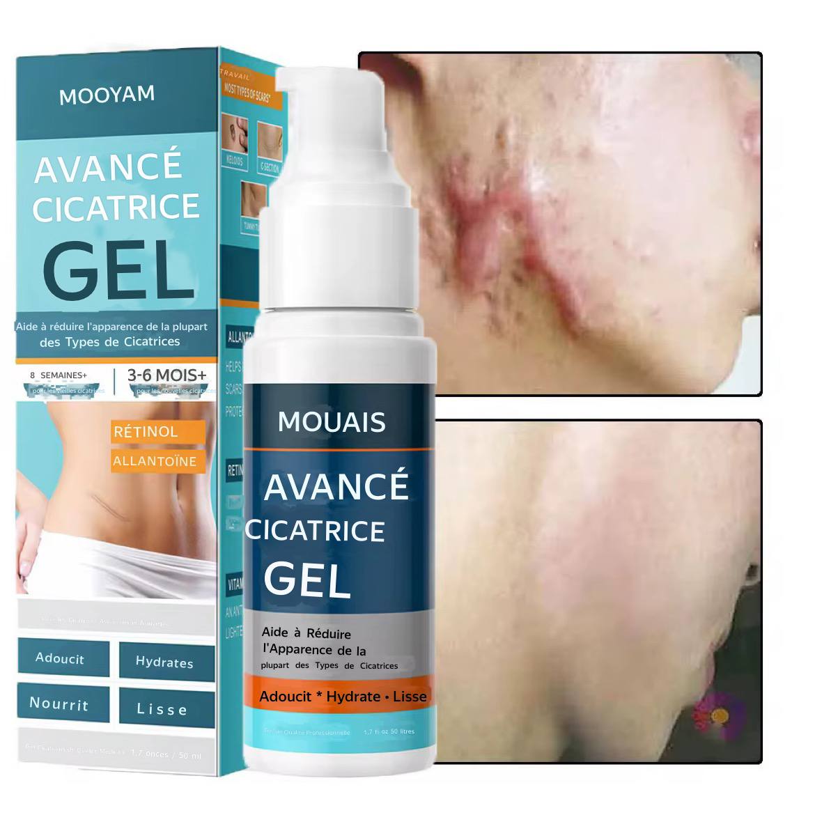 Gel Avancé Anti-Cicatrices Mooyam"