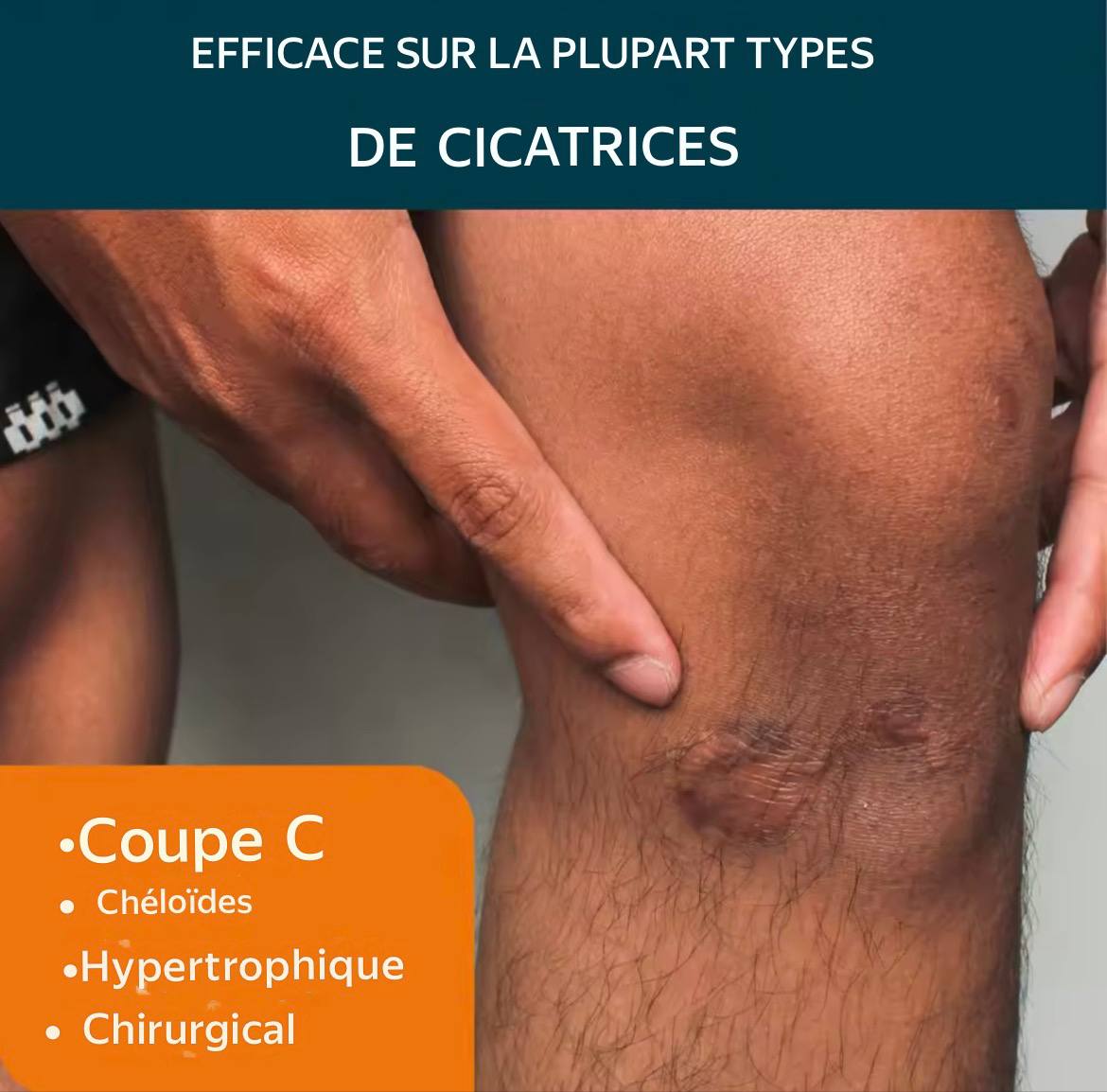 Gel Avancé Anti-Cicatrices Mooyam"